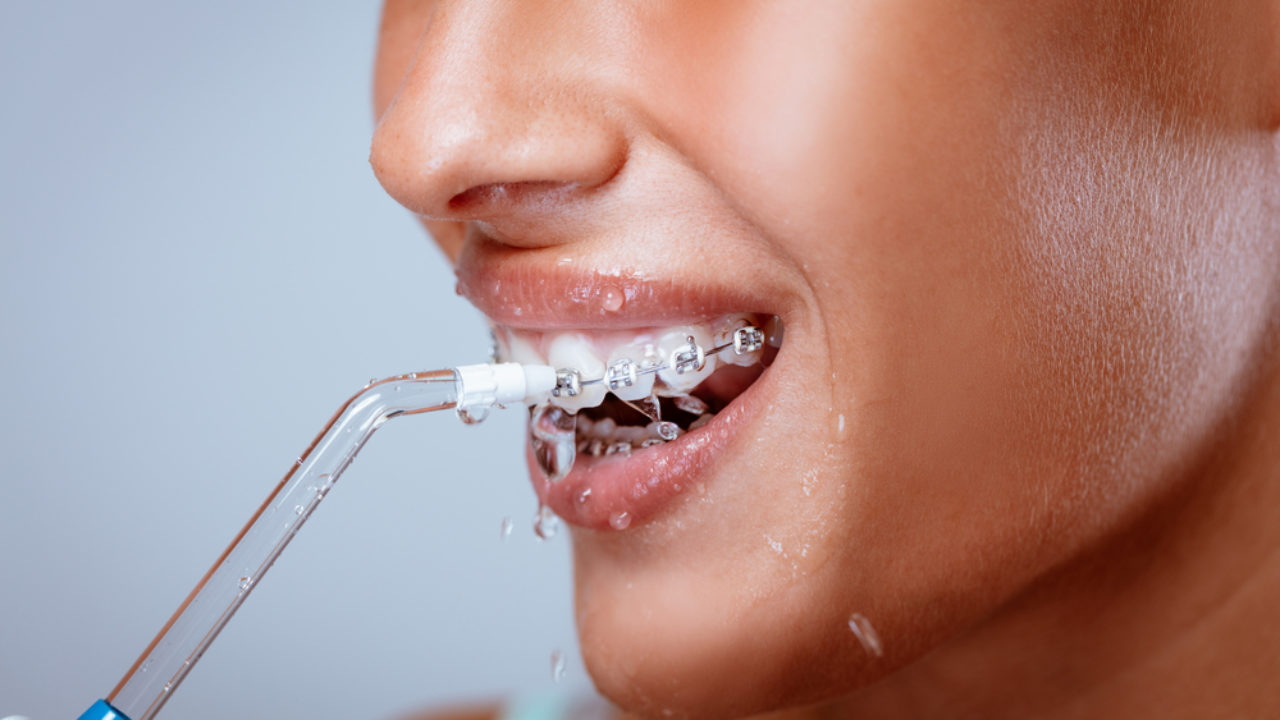 لماذا ننصحك باستخدام جهاز تنظيف الأسنان بالماء؟