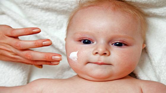 أفضل كريمات لعلاج إكزيما الوجه واليد للأطفال والكبار